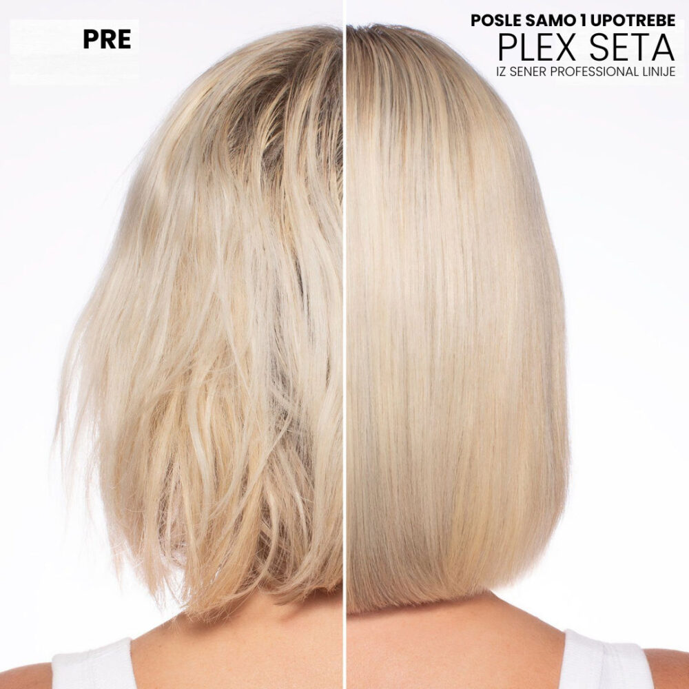 SENER PLEX SET + SPRAY 5 u 1 - Image 3
