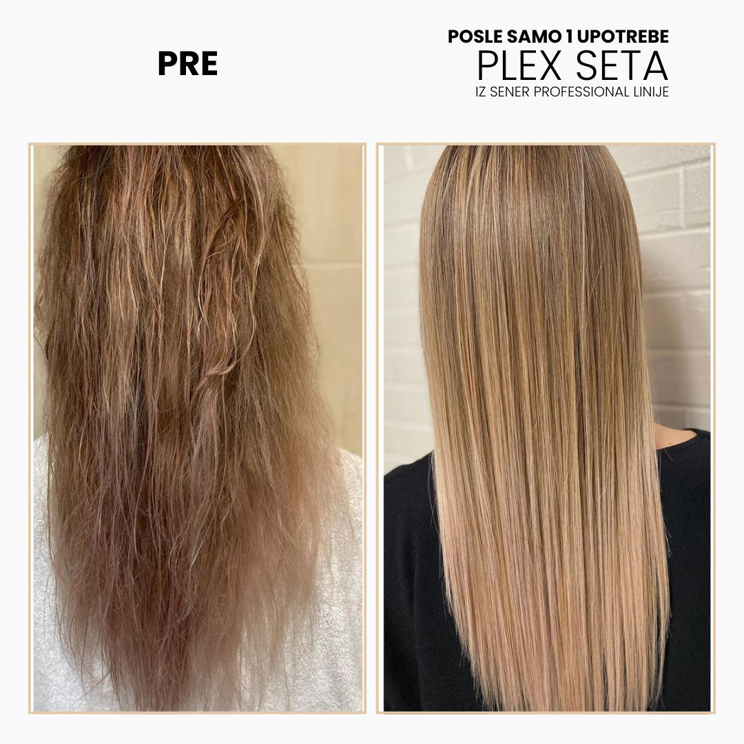 SENER PLEX SET + SPRAY 5 u 1 - Слика 5